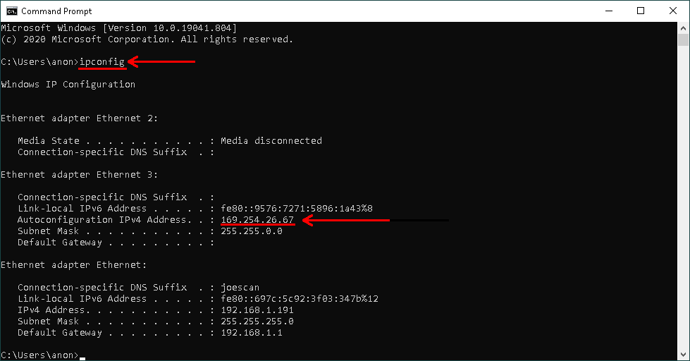 ipconfig